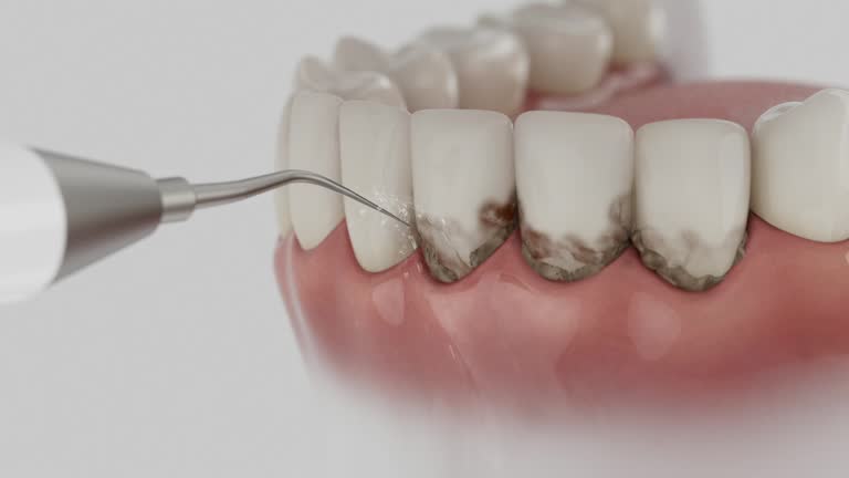 Trusted Dental Implants service in Perry, KS - Dentist Open Now
